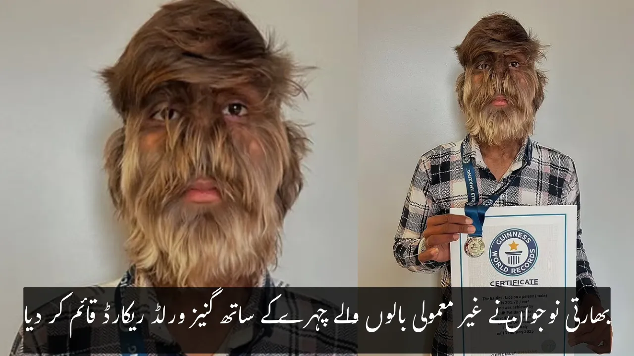 Indian Teen Sets Guinness World Record with His Exceptionally Hairy Face